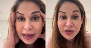 Maíra Cardi revela simetria falha no rosto após botox e desabafa