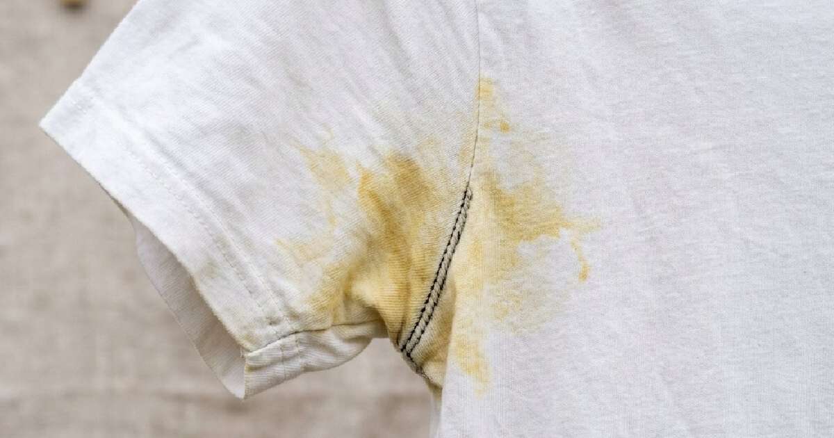 Como remover as manchas de desodorante das axilas nas roupas: a forma mais fácil de lavar as manchas amarelas